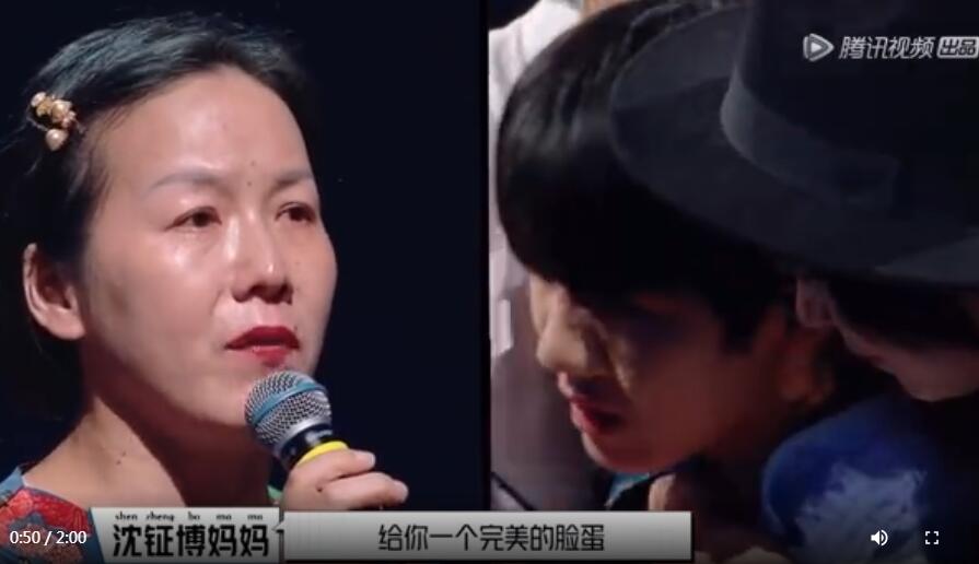 沈钲博脸上是什么胎记?他为什么不去做手术去掉胎记?