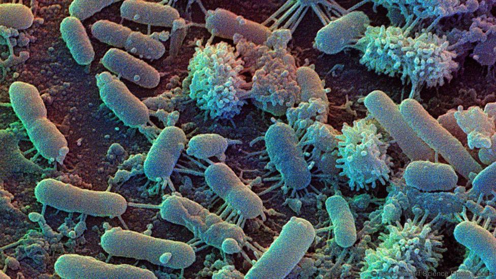 厨房里的几大细菌多严重知道吗？教你小妙招消灭细菌！