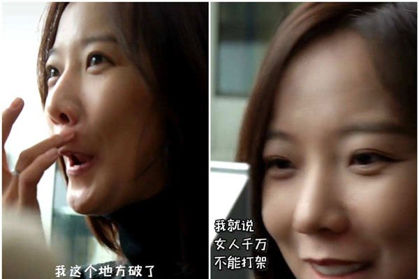 为什么说女孩破相命好 只要颜值不影响就会更好