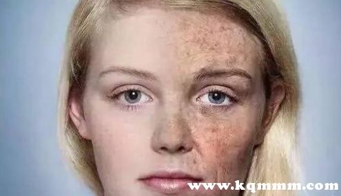 脸上一用防晒霜就过敏怎么办，涂防晒霜过敏了有什么处理方法