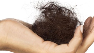 女白领发量剩3成，脱发问题成了“流行病”！