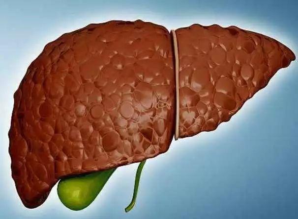 脂肪肝是什么原因造成的，肥胖是造成脂肪肝的主要原因！